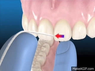 Luego de pasarlo suavemente entre los dientes con movimientos de zig zag, forma una C hasta introducirlo en el surco que se forma entre la encía y el diente.