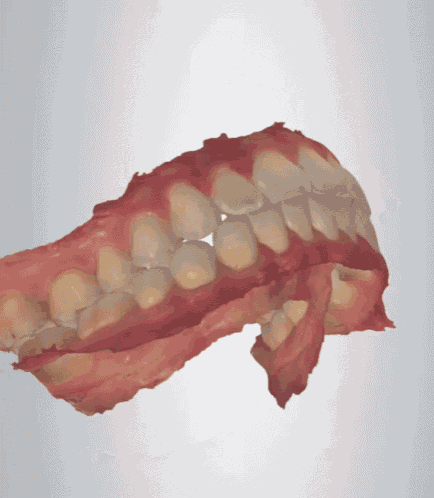 El escaneo dental 3D permite obtener las impresiones digitales de las arcadas superior e inferior, así como también un registro de mordida. Con estas impresiones digitales nuestros ortodoncistas certificados podrán realizar un plan de tratamiento personalizado de cada uno de nuestros pacientes.